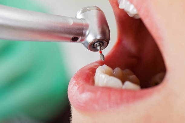 Best Tooth Infection Emergency Dentist  in Ferndale, PA
